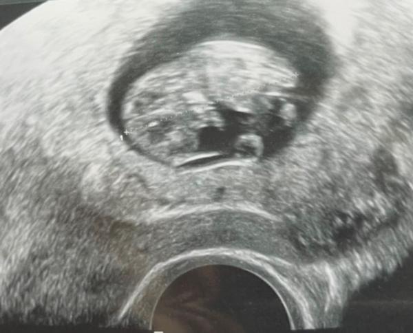 Bild zu Mein Baby ist gewachsen! Sooo glücklich - Forum für Mai - Mamis