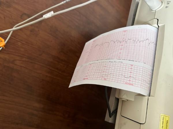Bild zu Polyhydramnie, Notching, Kontraktionen - Forum für Mai - Mamis
