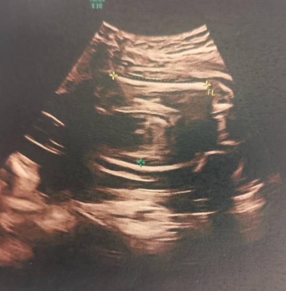 Bild zu Geschlecht - Forum für Mai - Mamis