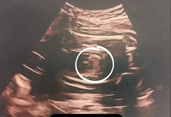 Bild zu Was meint ihr Junge oder Mädchen? - Forum für Mai - Mamis