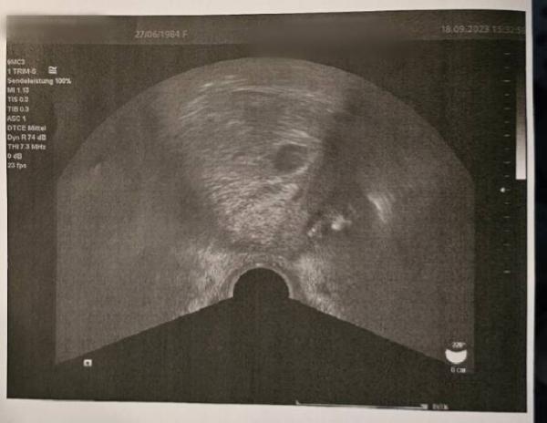 Bild zu Erster Ultraschall - Forum für Mai - Mamis