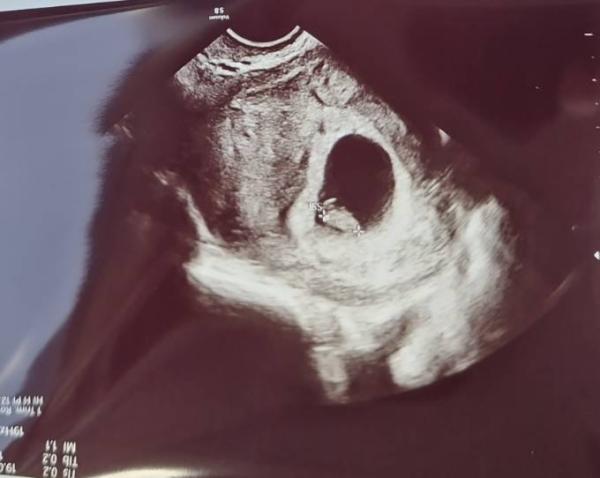 Bild zu 7+0 Ultraschallfoto - Forum für Mai - Mamis