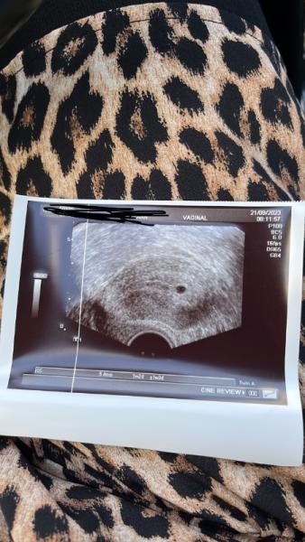 Bild zu Kleine Fruchthöhle, niedriger HCG 6+1 SSW - Forum für Mai - Mamis