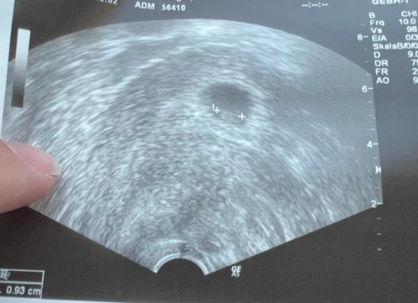 Bild zu Herzchen schlĂ€gt đ 7+3 - Forum fĂŒr Mai - Mamis