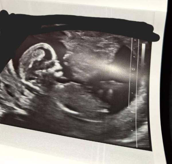 Bild zu Nub Theorie - Forum für Mai - Mamis