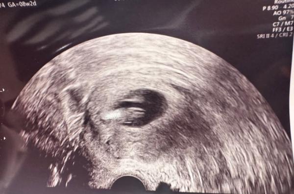 Bild zu Weiterer FA Termin - so happy! - Forum für Mai - Mamis
