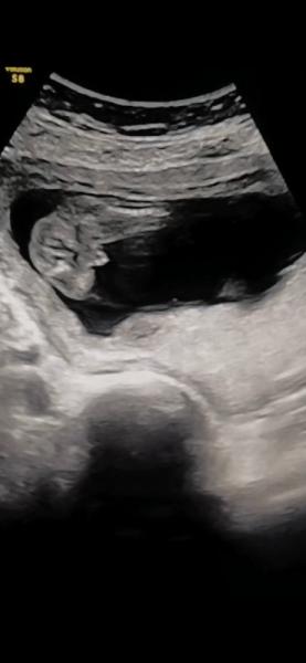 Bild zu Mädchen/Junge ? - Forum für Mai - Mamis