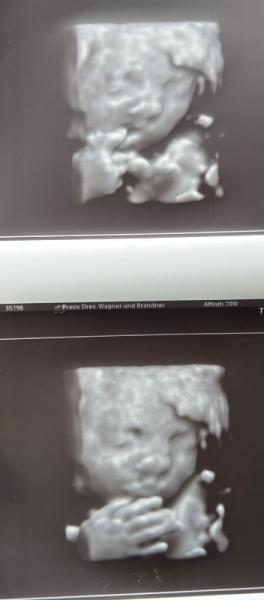 Bild zu Ultraschall - Forum für Mai - Mamis