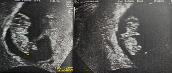 Bild zu Kleines Hamsterchen 🐹😊 - Forum für Mai - Mamis