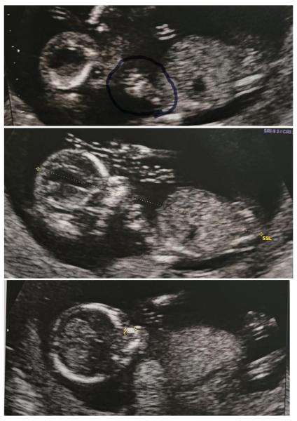 Bild zu Update Screening 😊 - Forum für Mai - Mamis