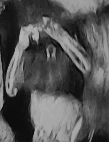 Bild zu Dickbauchdienstag verpasst - dann wird es halt ein Murmelmittwoch 🤰🏼😁 - Forum für Mai - Mamis