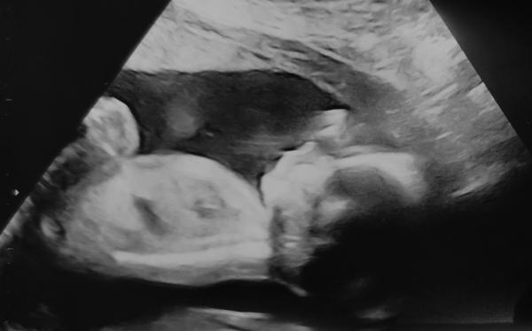 Bild zu Dickbauchdienstag verpasst - dann wird es halt ein Murmelmittwoch 🤰🏼😁 - Forum für Mai - Mamis