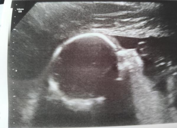 Bild zu 2. großer Ultraschall - Forum für Mai - Mamis