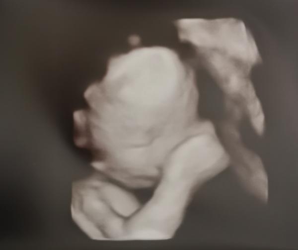 Bild zu Update Verlauf Schwangerschaft - Forum für Mai - Mamis