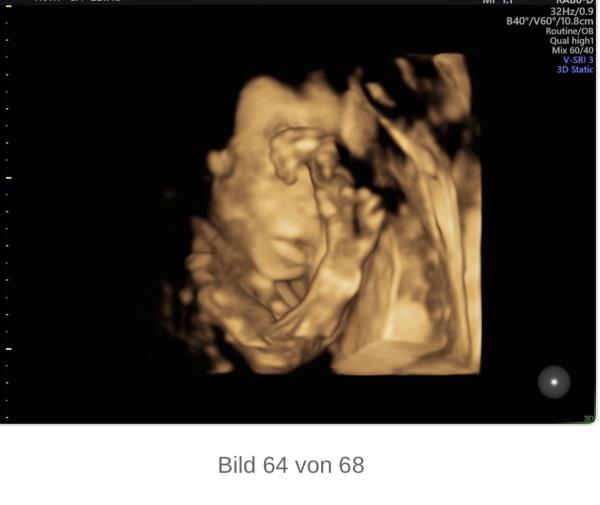 Bild zu Erster Beitrag von mir 😊👋🏻 - Forum für Mai - Mamis