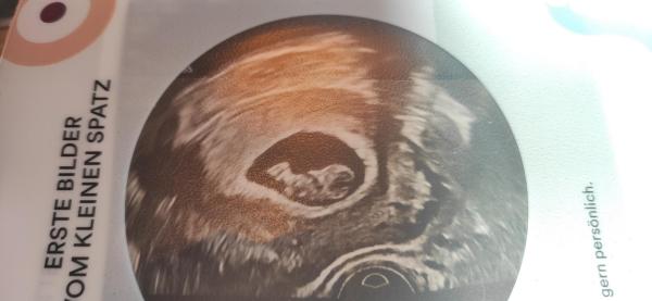 Bild zu Huhu,ist noch jmd da ? :) Ich hatte heute wieder FA Termin. - Forum für Mai - Mamis