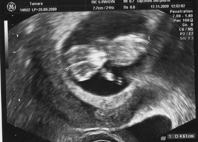Bild zu endlich 13. Woche - Forum für Juni - Mamis