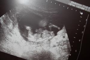 Bild zu Schaut nach Bube Nummer 3 aus... - Forum für Juni - Mamis