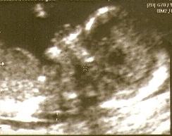 Bild zu komme vom FA und Bildchen :-) - Forum für Juni - Mamis