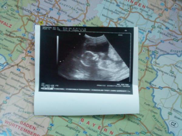Bild zu zurück von fa - Forum für Juni - Mamis