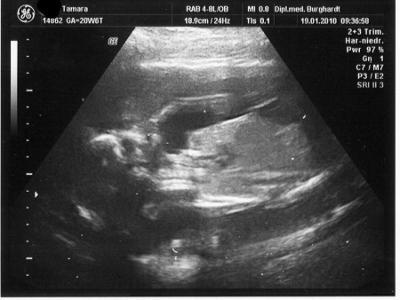 Bild zu Bildchen von heute - Forum für Juni - Mamis
