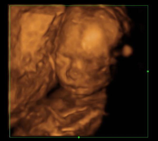 Bild zu d3 Bild von meiner Maus - Forum für Juni - Mamis