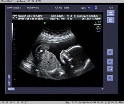 Bild zu Bilder von der Feindiagnostik gestern, Outing bestätigt :-) - Forum für Juni - Mamis
