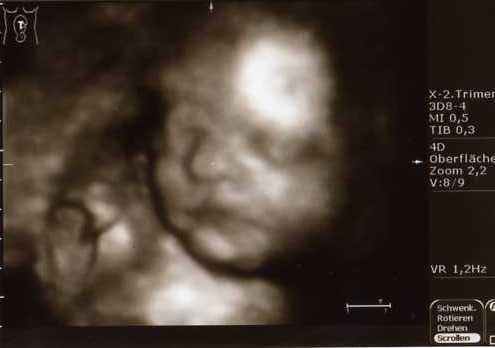 Bild zu unsere 4D Bilder - Forum für Juni - Mamis
