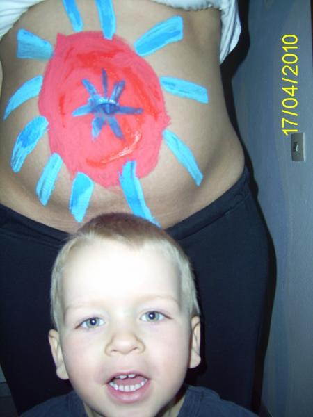 Bild zu
