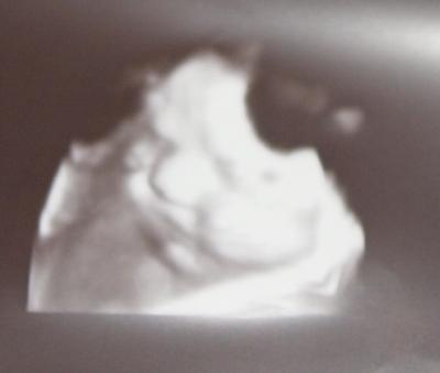 Bild zu US-Bilder von 33+1 :-) - Forum für Juni - Mamis