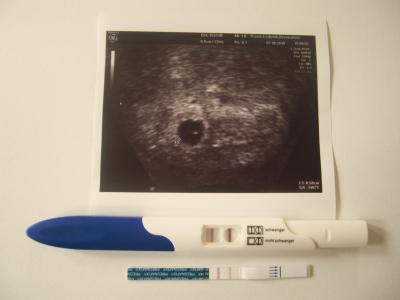 Bild zu 1.Ultraschallbild, bei 5+2 SSW - Forum für Juni - Mamis