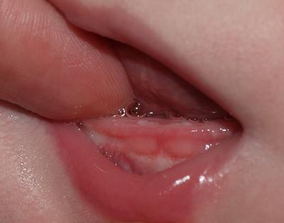 Bild zu foto von den zähnen - Forum für Juni - Mamis