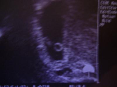 Bild zu 1. FA-Besuch................FREU - Forum für Juni - Mamis