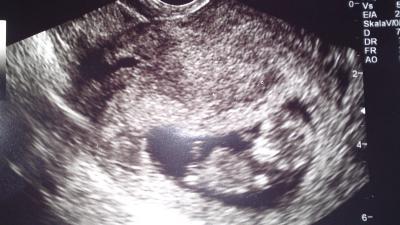 Bild zu Hallo bin zurück vom FA - Forum für Juni - Mamis