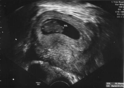 Bild zu Hilfe, ich wurde von Außerirdischen entführt... - Forum für Juni - Mamis