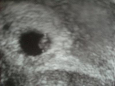 Bild zu Mein kleines Wunder in mir ... - Forum für Juni - Mamis