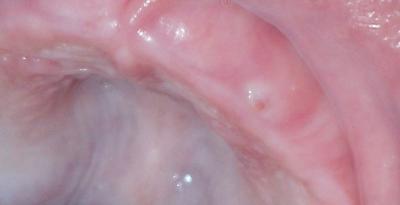 Bild zu Zahn? + Bild - Forum für Juni - Mamis