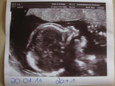 Bild zu Lachbild vom Zwergi :-) - Forum für Juni - Mamis