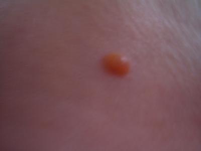 Bild zu Hat jemand eine Idee was das sein könnte? - Forum für Juni - Mamis