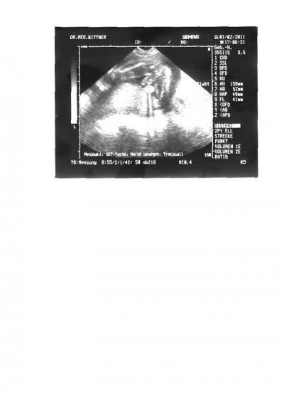 Bild zu Hiiilllffee wer kann uns helfen?? FA verriet nicht was es wird..Mädchen o. Junge - Forum für Juni - Mamis