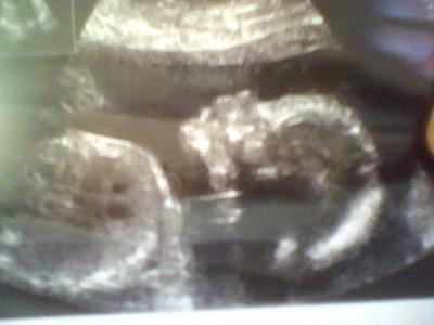 Bild zu Unser Mädchen - Forum für Juni - Mamis