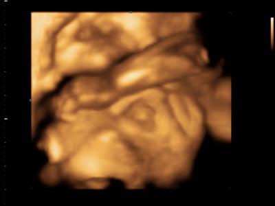 Bild zu heute 3D Bilder machen lassen - Forum für Juni - Mamis