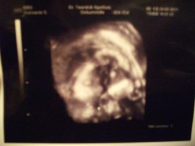 Bild zu Lebe auch noch (Mein Wochenbericht) - Forum für Juni - Mamis