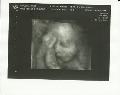 Bild zu Bauchbild und 3D-Bilder von unserem Schatz - Forum für Juni - Mamis