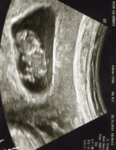 Bild zu zurück vom doc - Forum für Juni - Mamis
