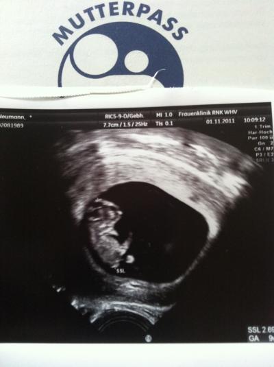 Bild zu Mein Baby bei 9+4 =) - Forum für Juni - Mamis