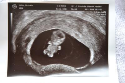Bild zu Zurück vom Doc! Mit Gummibärchen-Bild! - Forum für Juni - Mamis