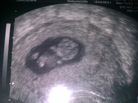 Bild zu 