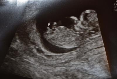Bild zu So! 2. Versuch! Das Bildchen von gestern! - Forum für Juni - Mamis