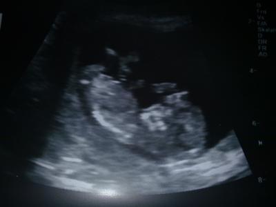 Bild zu Mein FA-Bericht (ein bissl lang) - Forum für Juni - Mamis